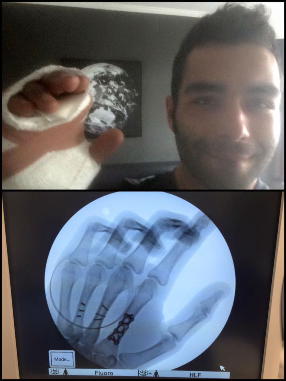 Petrucci animado após a operação