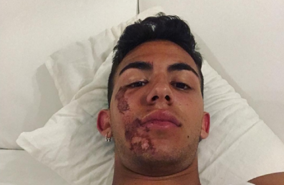 Moto3: Enea Bastianini ferido após queda de scooter