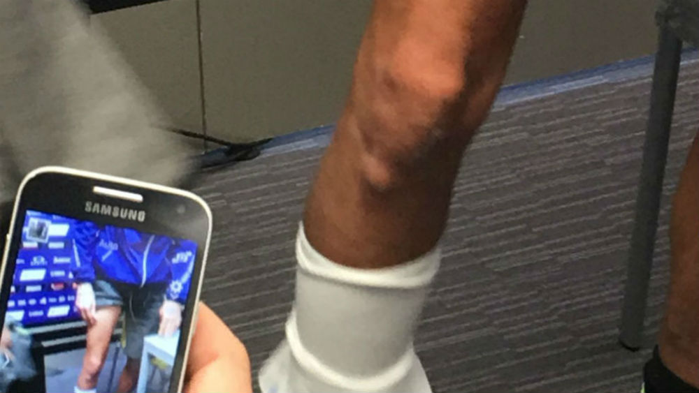 MotoGP: Valentino Rossi mostra perna direita para acabar com especulação