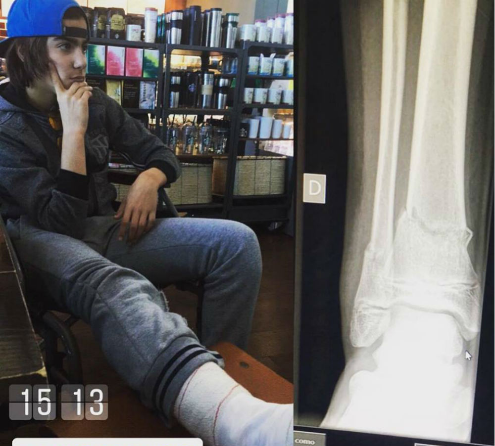 MX: Afonso Gaidão vai perder arranque do campeonato espanhol