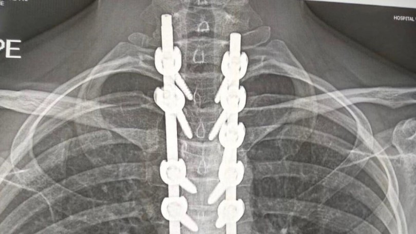 SBK, 2021: Ana Carrasco, uma força da natureza