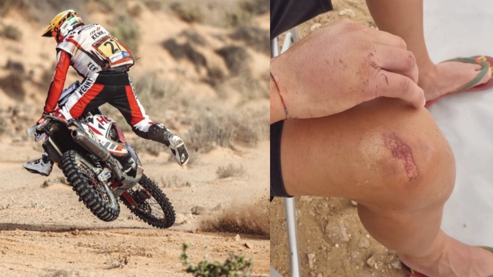 Joaquim Rodrigues, Rally Marrocos, Etapa 2: “Decidi parar para não magoar ainda mais as mãos”