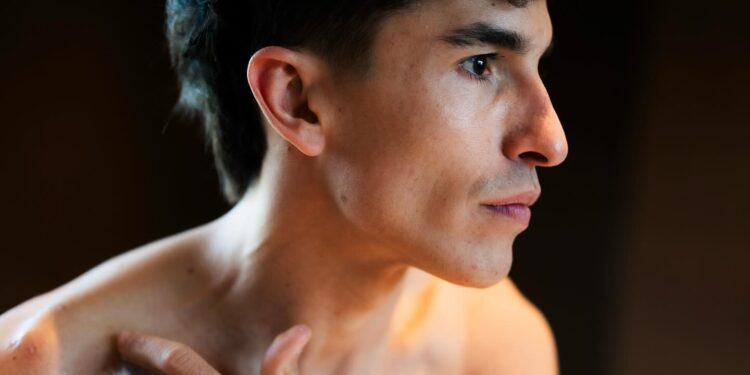 MotoGP: Cirurgião de Marc Márquez revela impacto das sete operações ‘está a 50%’