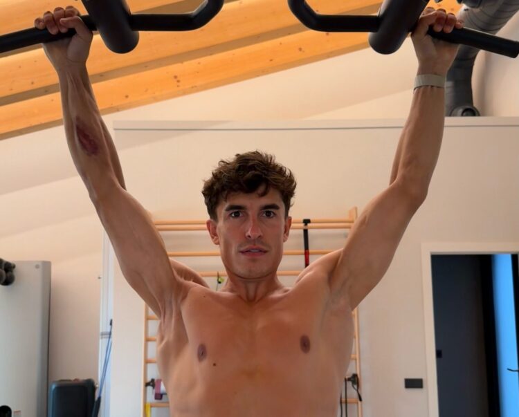 MotoGP: As marcas de sete cirurgias no corpo de Marc Márquez